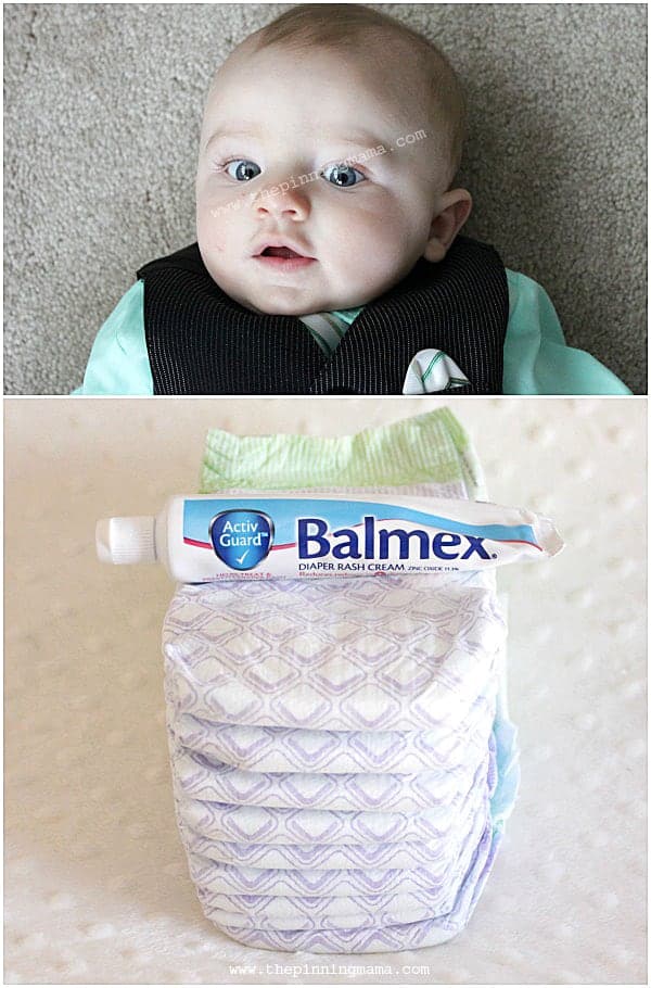 Best ideas on how to treat diaper rash and keep it away